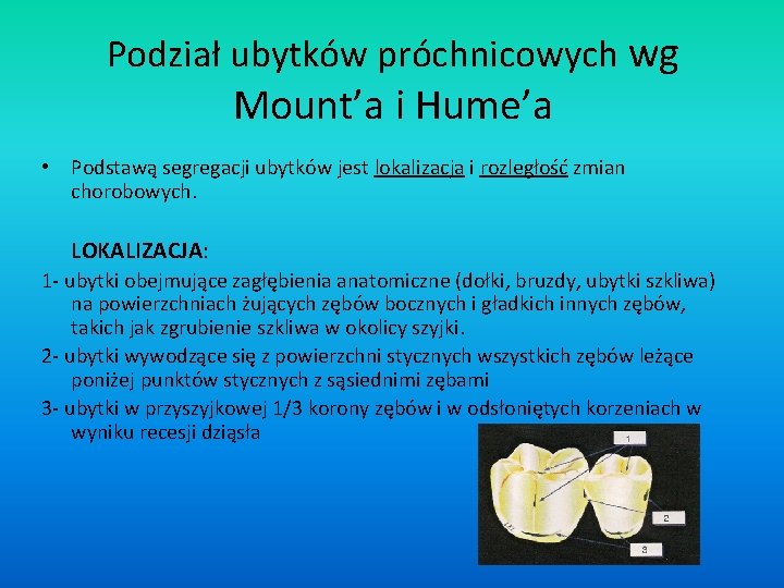 Podział ubytków próchnicowych wg Mount’a i Hume’a • Podstawą segregacji ubytków jest lokalizacja i