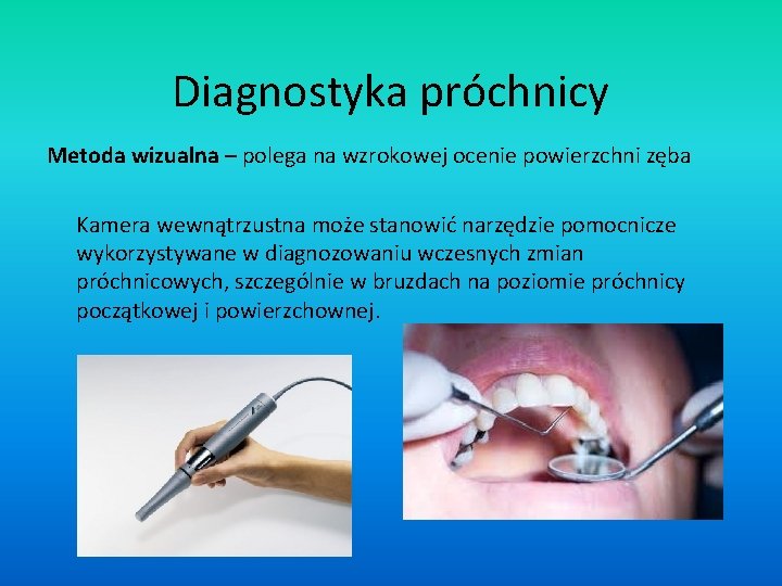 Diagnostyka próchnicy Metoda wizualna – polega na wzrokowej ocenie powierzchni zęba Kamera wewnątrzustna może