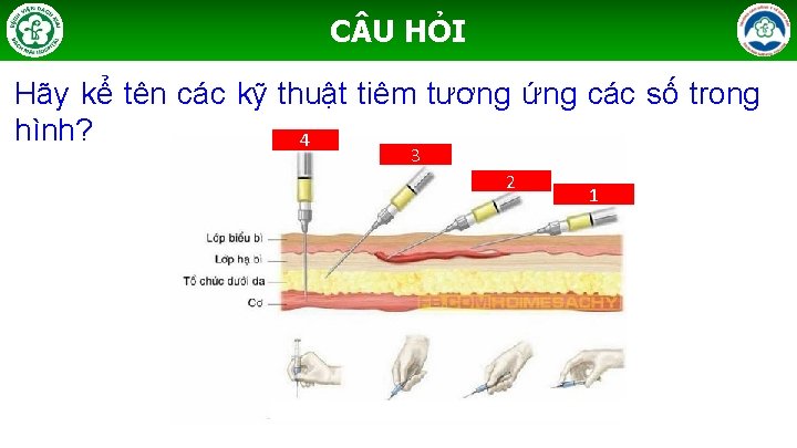 C U HỎI Hãy kể tên các kỹ thuật tiêm tương ứng các số