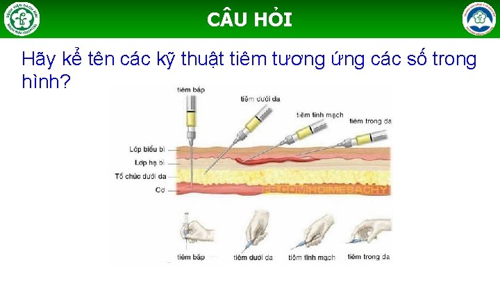 C U HỎI Hãy kể tên các kỹ thuật tiêm tương ứng các số