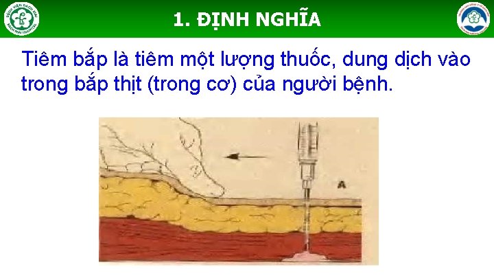 1. ĐỊNH NGHĨA Tiêm bắp là tiêm một lượng thuốc, dung dịch vào trong