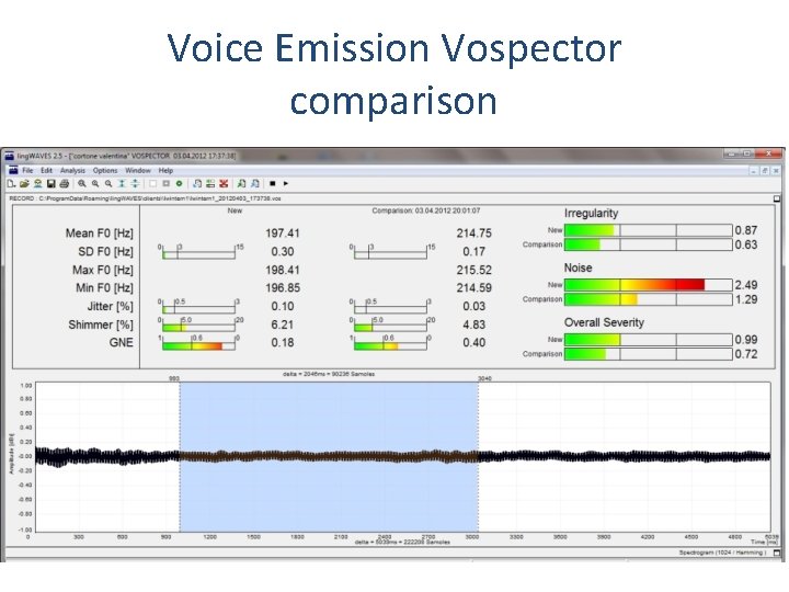 Voice Emission Vospector comparison 