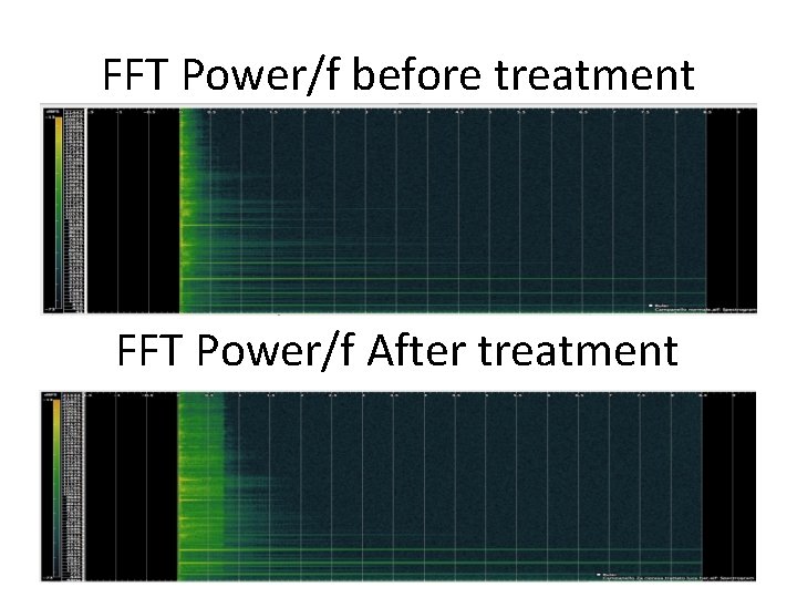 FFT Power/f before treatment FFT Power/f After treatment 