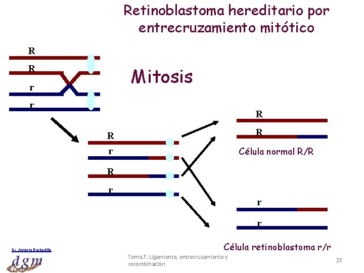 Retinoblastoma hereditario por entrecruzamiento mitótico R R Mitosis r r R R R Célula
