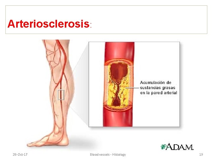 Arteriosclerosis: 28 -Oct-17 Blood vessels - Histology 19 