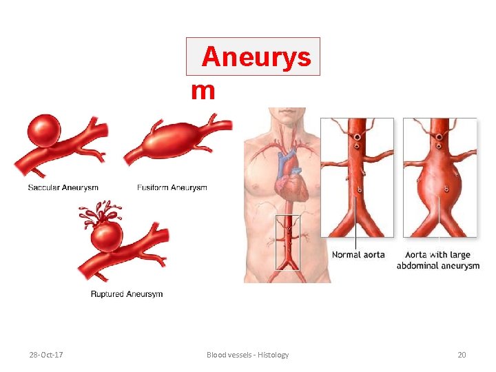 Aneurys m 28 -Oct-17 Blood vessels - Histology 20 