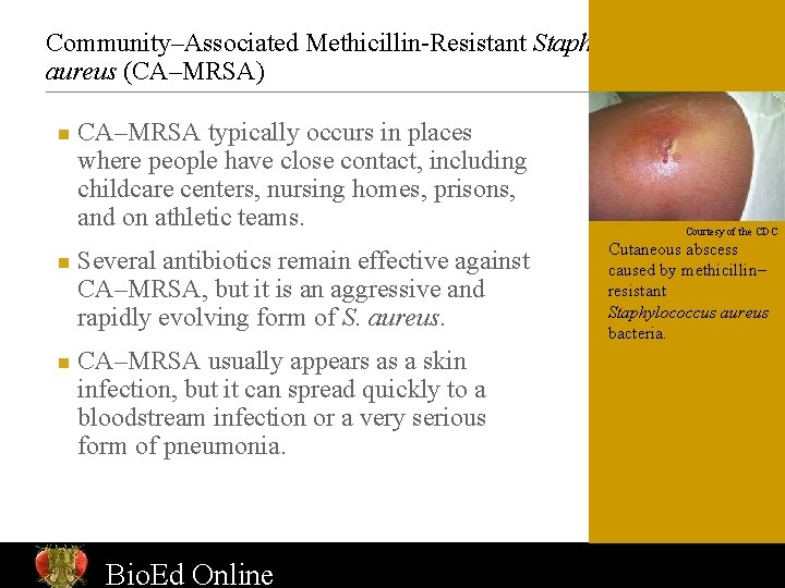 Community–Associated Methicillin-Resistant Staphylococcus aureus (CA–MRSA) n n n CA–MRSA typically occurs in places where