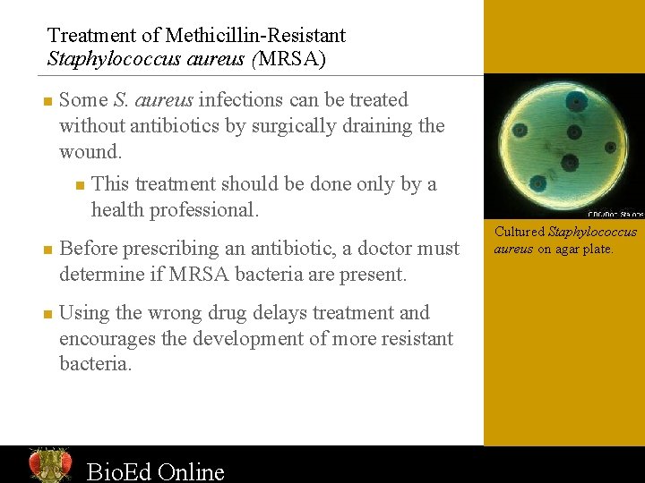 Treatment of Methicillin-Resistant Staphylococcus aureus (MRSA) n n n Some S. aureus infections can
