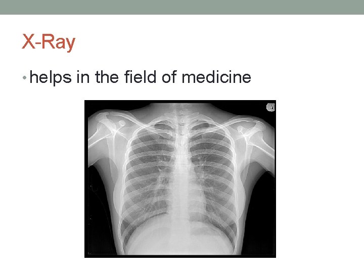 X-Ray • helps in the field of medicine 