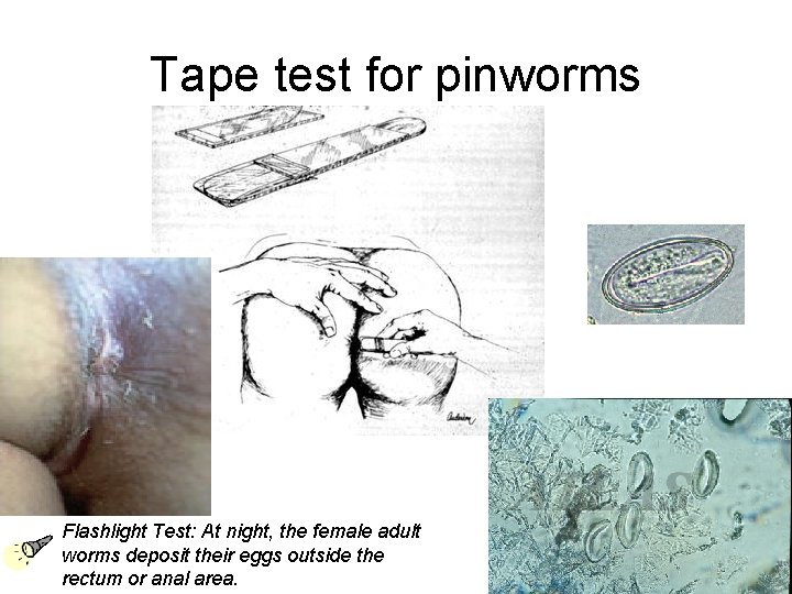 Tape test for pinworms Flashlight Test: At night, the female adult worms deposit their