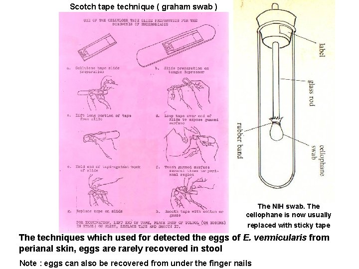 Scotch tape technique ( graham swab ) The NIH swab. The cellophane is now