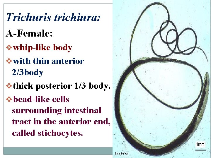 Trichuris trichiura: A-Female: vwhip-like body vwith thin anterior 2/3 body vthick posterior 1/3 body.