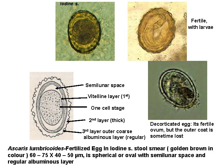 Iodine s. Fertile, with larvae Semilunar space Vitelline layer (1 st) One cell stage