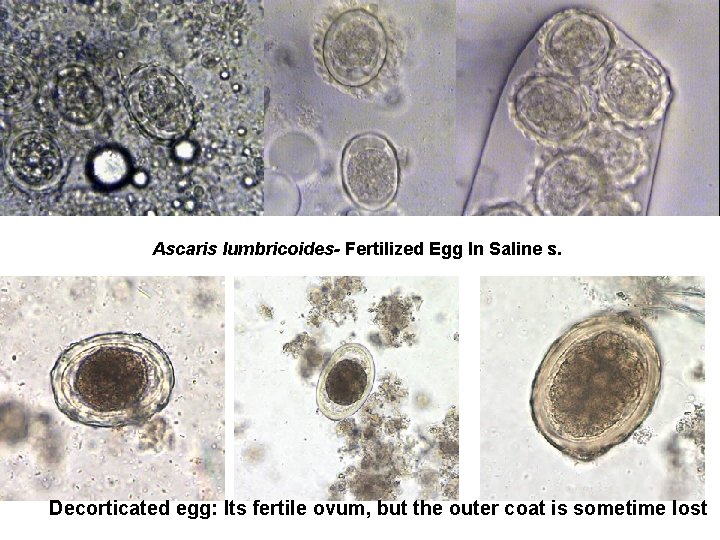 Ascaris lumbricoides- Fertilized Egg In Saline s. Decorticated egg: Its fertile ovum, but the