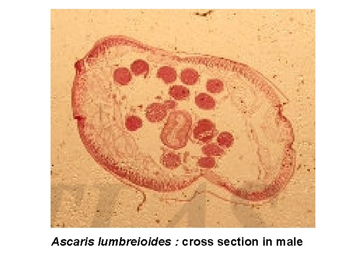Ascaris lumbreioides : cross section in male 