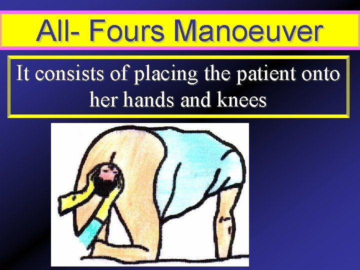 All- Fours Manoeuver It consists of placing the patient onto her hands and knees