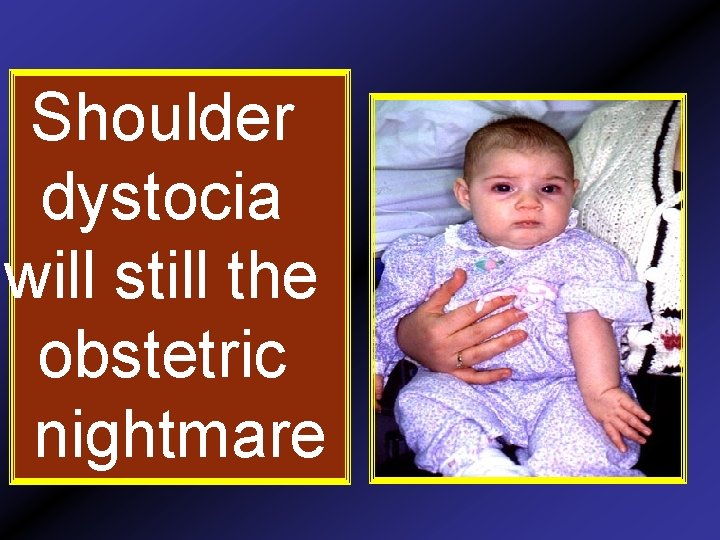 Shoulder dystocia will still the obstetric nightmare 