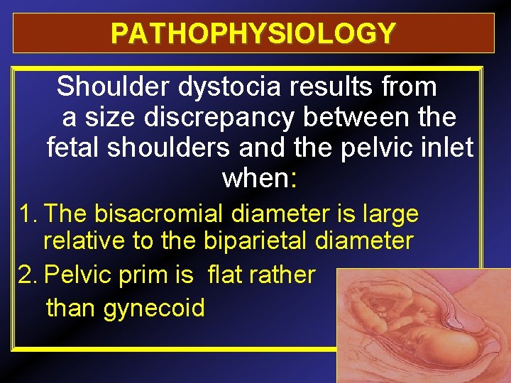 PATHOPHYSIOLOGY Shoulder dystocia results from a size discrepancy between the fetal shoulders and the
