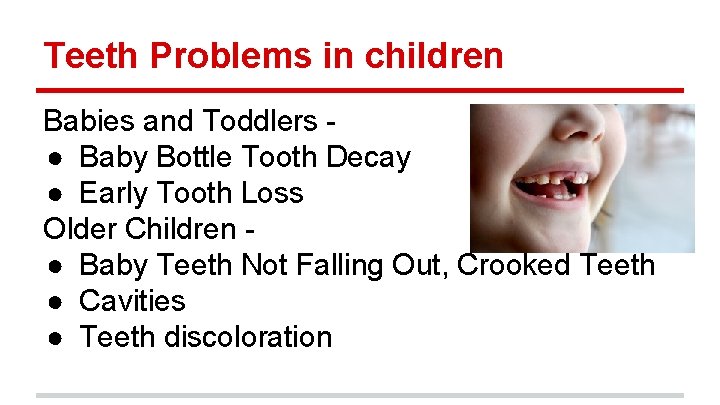 Teeth Problems in children Babies and Toddlers ● Baby Bottle Tooth Decay ● Early