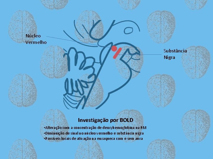 Núcleo Vermelho Substância Nigra Investigação por BOLD • Alteração com a concentração de deoxyhemoglobina