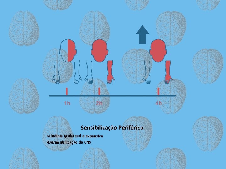 Sensibilização Periférica • Alodinia ipsilateral e expansiva • Desensibilização do CNS 