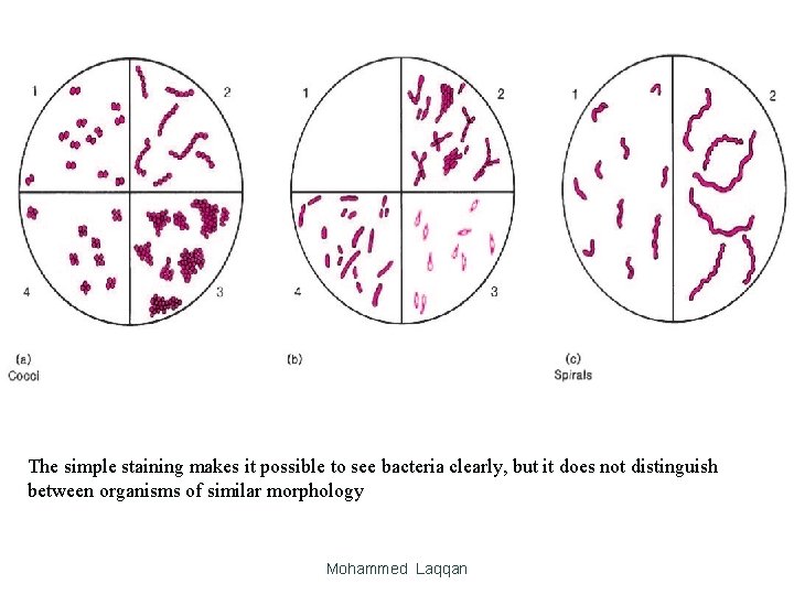 The simple staining makes it possible to see bacteria clearly, but it does not