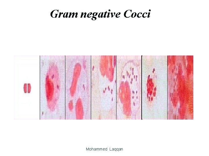 Gram negative Cocci Mohammed Laqqan 