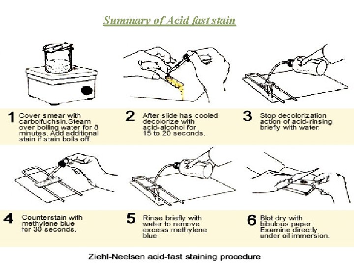 Summary of Acid fast stain Mohammed Laqqan 