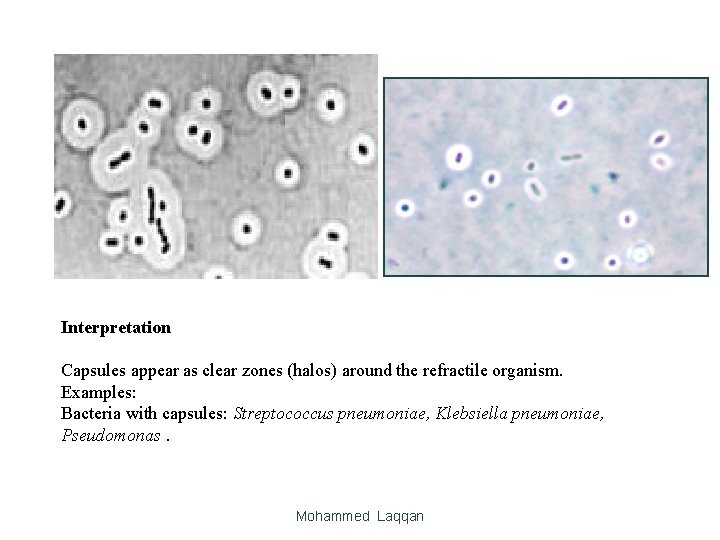Interpretation Capsules appear as clear zones (halos) around the refractile organism. Examples: Bacteria with