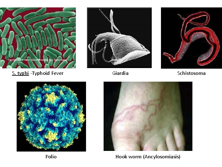 S. typhi -Typhoid Fever Polio Giardia Schistosoma Hook worm (Ancylosomiasis) 