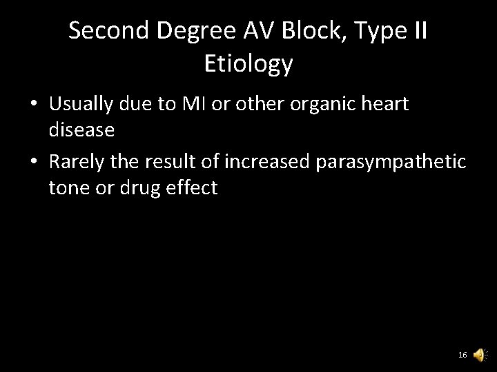 Second Degree AV Block, Type II Etiology • Usually due to MI or other