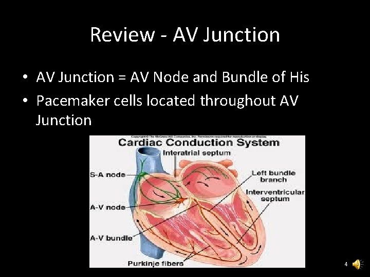 Review - AV Junction • AV Junction = AV Node and Bundle of His