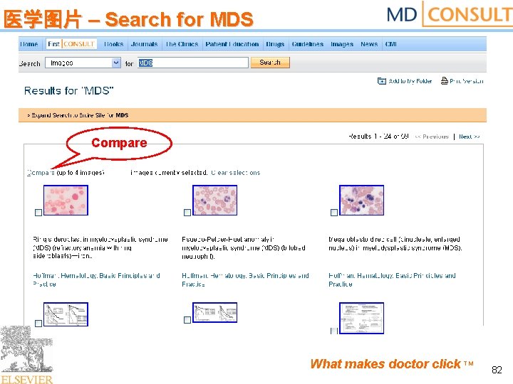 医学图片 – Search for MDS Compare What makes doctor click TM 82 