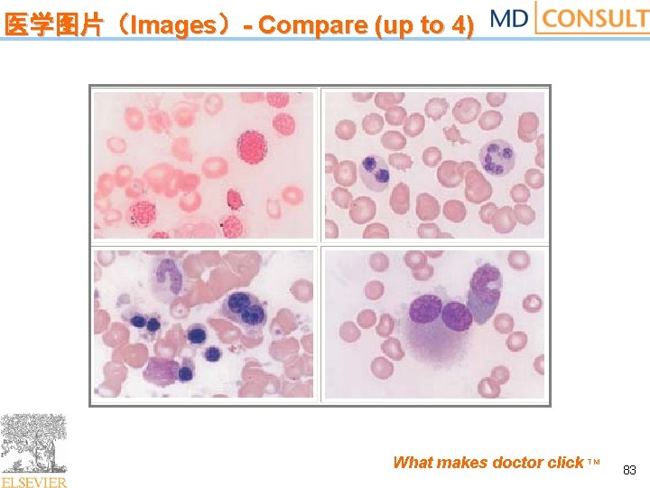 医学图片（Images）- Compare (up to 4) What makes doctor click TM 83 