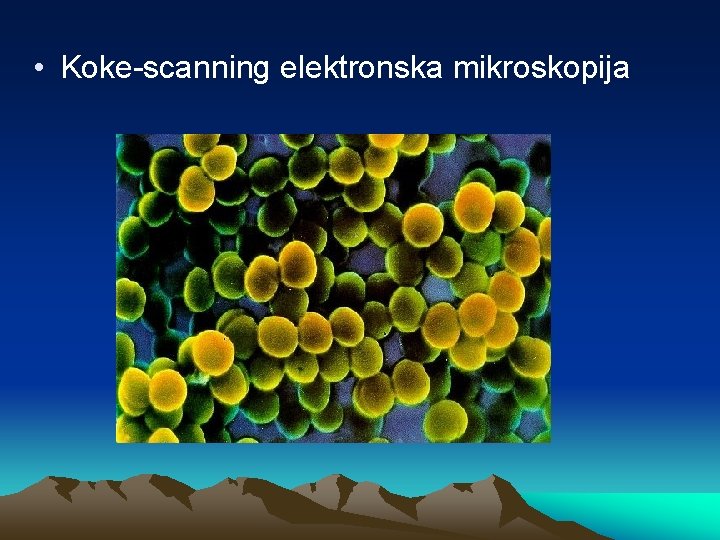  • Koke-scanning elektronska mikroskopija 