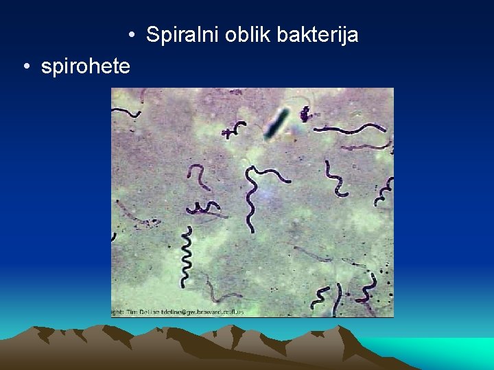  • Spiralni oblik bakterija • spirohete 