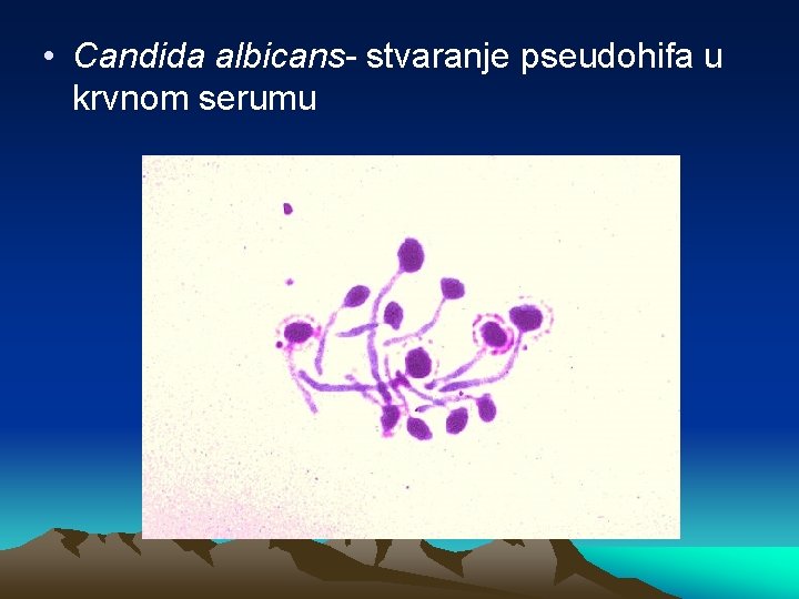  • Candida albicans- stvaranje pseudohifa u krvnom serumu 