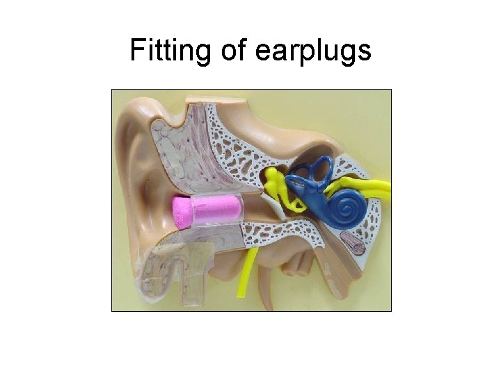 Fitting of earplugs 
