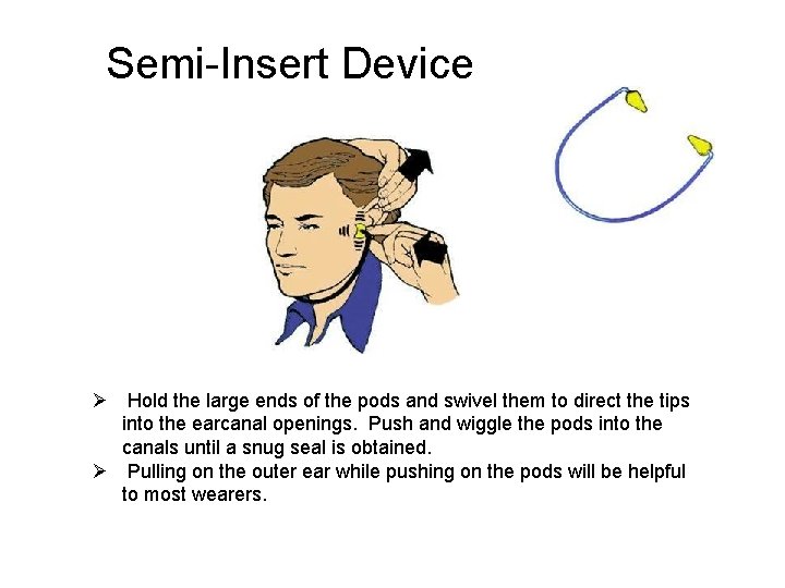 Semi-Insert Device Ø Hold the large ends of the pods and swivel them to