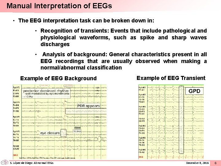 Manual Interpretation of EEGs • The EEG interpretation task can be broken down in: