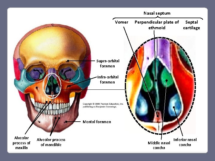 Nasal septum Vomer Perpendicular plate of Septal ethmoid cartilage Supra-orbital foramen Infra-orbital foramen Mental