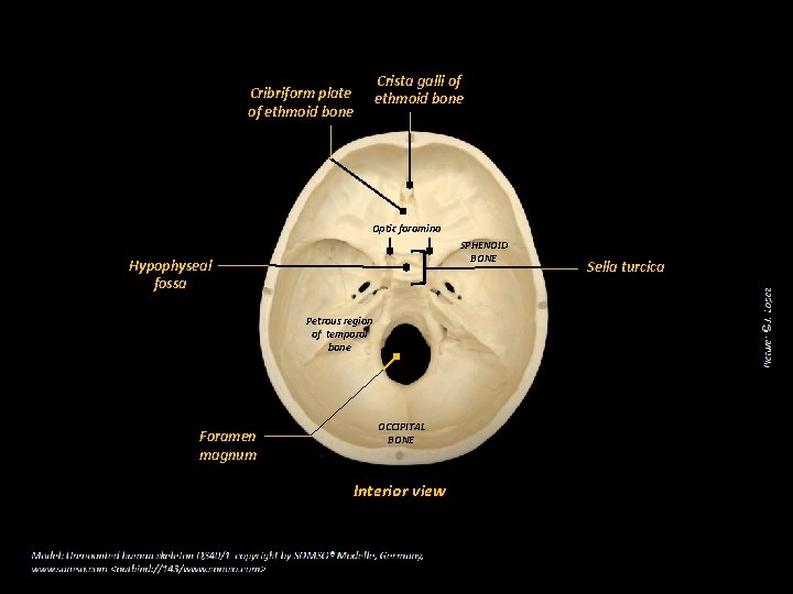 Crista galli of ethmoid bone Cribriform plate of ethmoid bone Optic foramina SPHENOID BONE