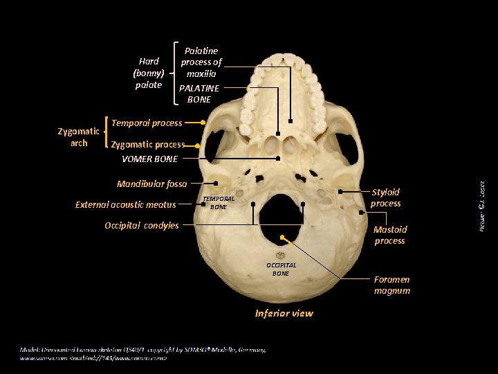 Hard (bonny) palate Zygomatic arch Palatine process of maxilla PALATINE BONE Temporal process Zygomatic