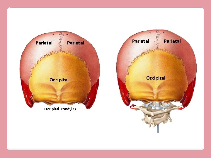 Parietal Occipital condyles Parietal Occipital 