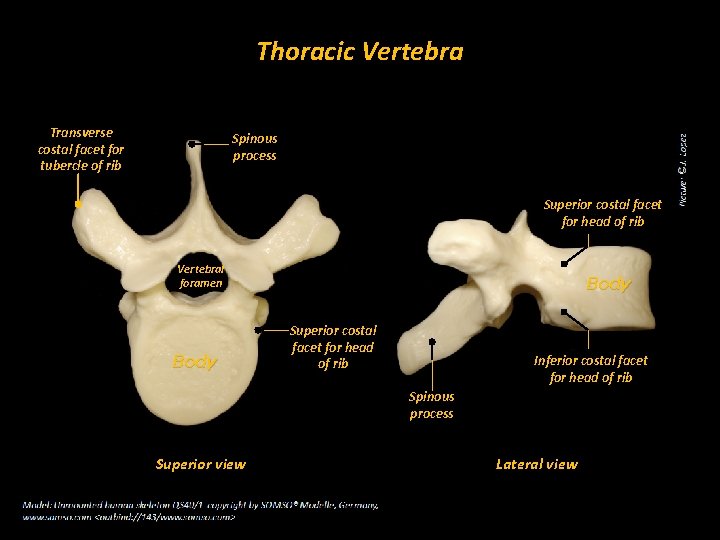 Thoracic Vertebra Transverse costal facet for tubercle of rib Spinous process Superior costal facet