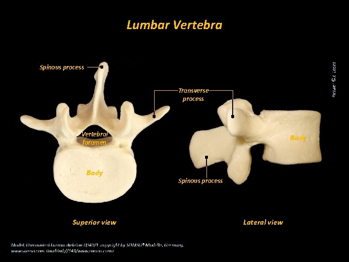 Lumbar Vertebra Spinous process Transverse process Vertebral foramen Body Superior view Body Spinous process
