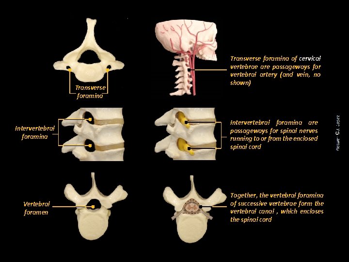 Transverse foramina Intervertebral foramina Vertebral foramen Transverse foramina of cervical vertebrae are passageways for