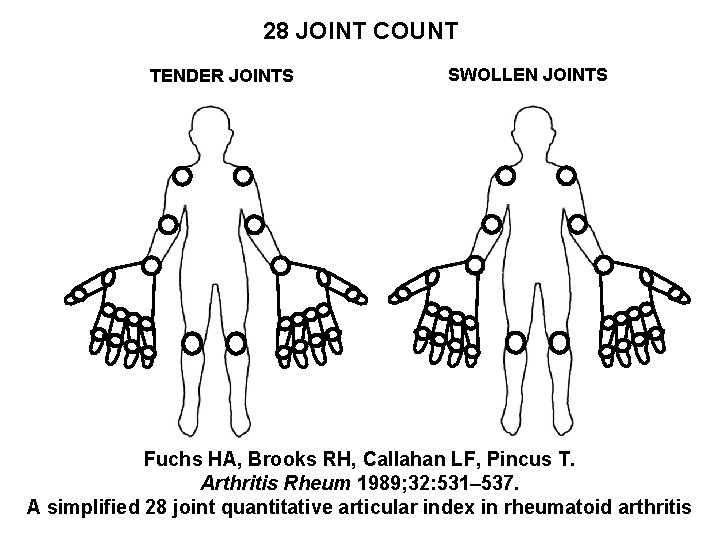 28 JOINT COUNT TENDER JOINTS SWOLLEN JOINTS Fuchs HA, Brooks RH, Callahan LF, Pincus