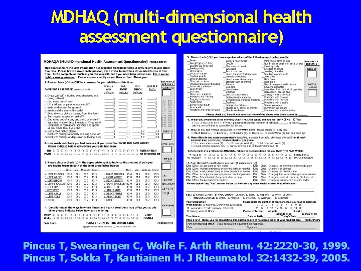 MDHAQ (multi-dimensional health assessment questionnaire) 70 Pincus T, Swearingen C, Wolfe F. Arth Rheum.