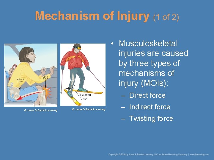 Mechanism of Injury (1 of 2) • Musculoskeletal injuries are caused by three types